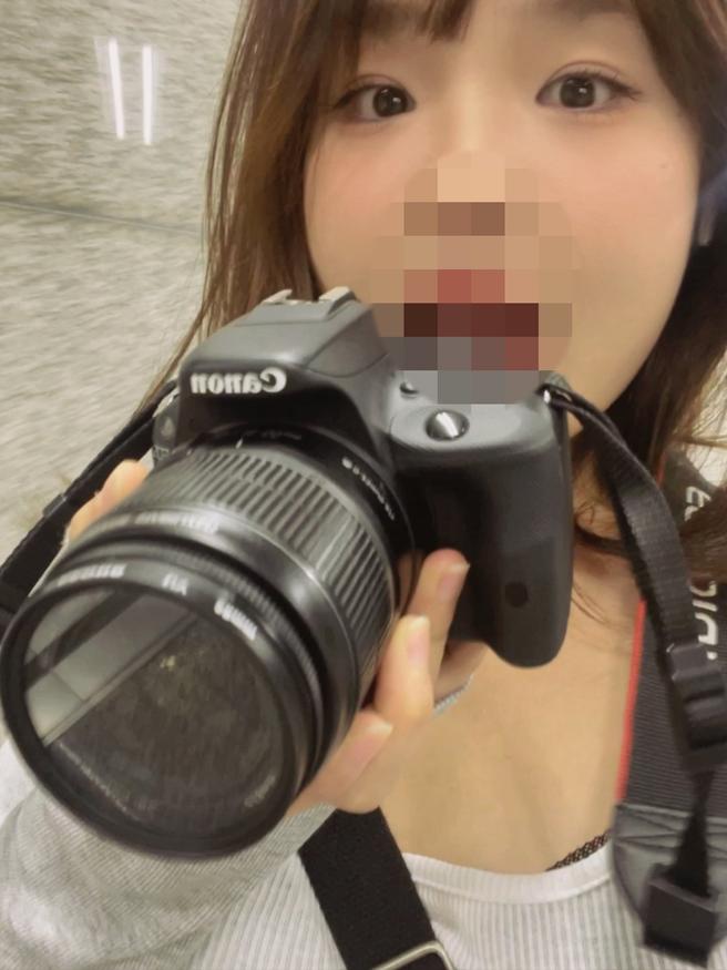แก้ไขรูปตาและกล้ามเนื้อตาอ่อนแรง