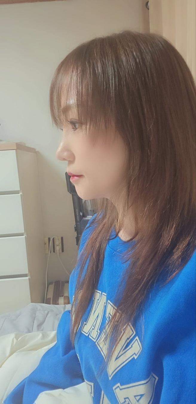 안심 코 재수술