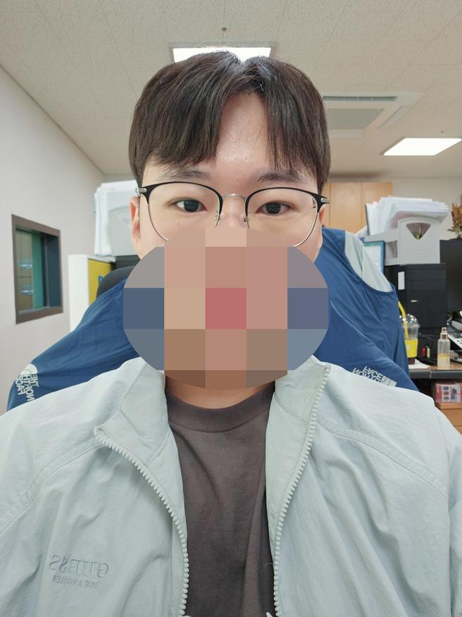 男性眼睛矫正