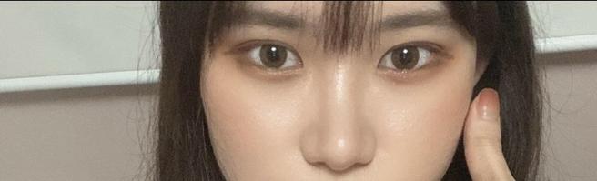 안심 눈 재수술