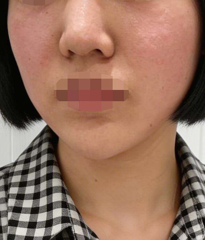 피부 속이 비어있는 느낌이었는데 리즈네 받고 바로 촉촉해진 느낌이 들어요~!