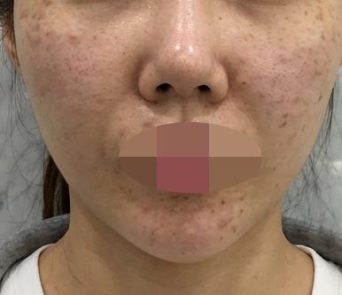 빠른 대응에 친절함까지, 리쥬란 이번에도 잘 받아봤어요ㅎ