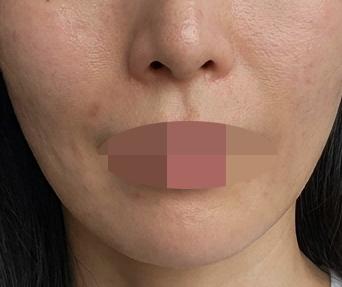데스크부터 의사 선생님까지 모두 신경 써 주셔서 매번 만족이에요ㅎㅎ