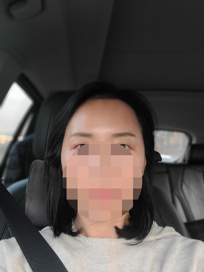 이제 곧 마스크 벗을텐데 때맞춰 잘 한것 같아요.