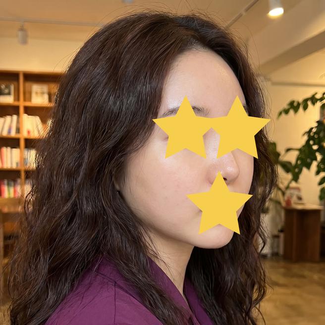 촉촉한 피부 만들러 왔다가 효과에 반해버림~ 쥬베룩 3일차
