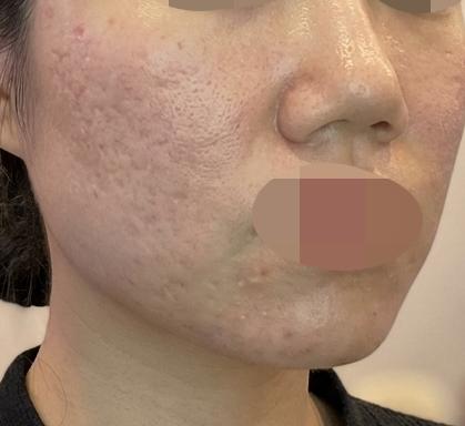 포텐자 받았는데 꼼꼼하고 가격 동일해서 다음 달에도 오려고요~