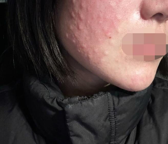 긴장하고 갔는데 다들 친절해서 편하게 받은 것 같아요 ㅎㅎ