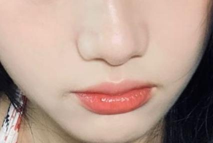 맞은 지 3주 됐는데 피부에서 빛이 나요…쥬베룩 인정이에요