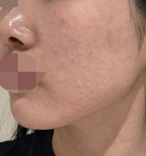 대기 없이 바로 받았고 꼼꼼해서 만족인 것 같아요~