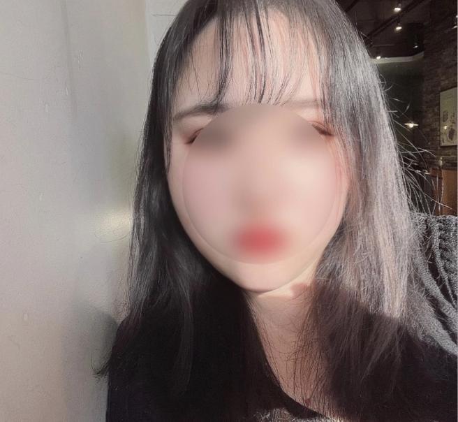 ดูดไขมันใบหน้า