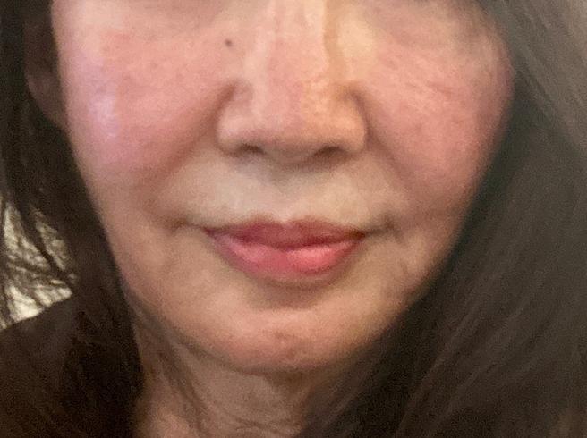 모피우스8 1주 후 솔직 후기, 만족스러운 변화