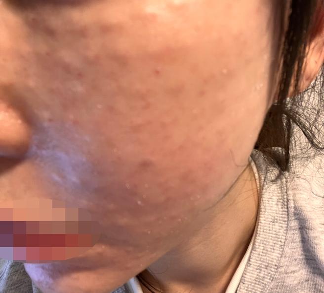 리즈네 받았는데 건조함 잡히고 친절해서 좋았어요 ㅎㅎ