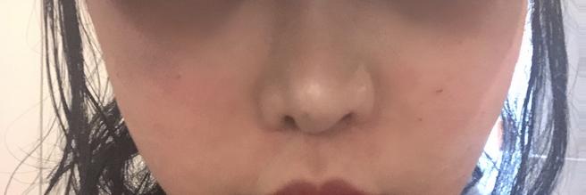 꼼꼼하게 시술해주고 정품 인증까지, 믿고 다니는 곳이에요