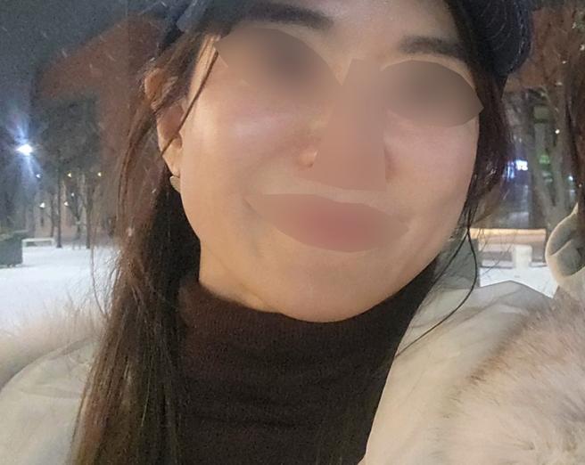 푸석한 피부가 신경 쓰여서 받았어요