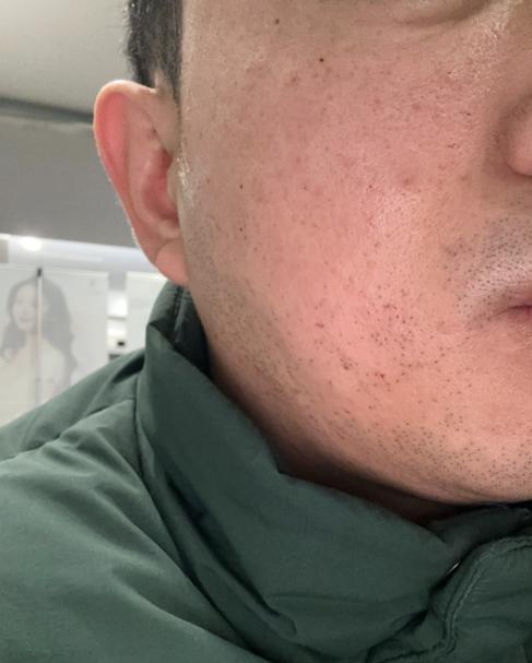 나이 들어 보이는 푸석함, 쥬베룩+연어로 해결 중! 2회차 방문