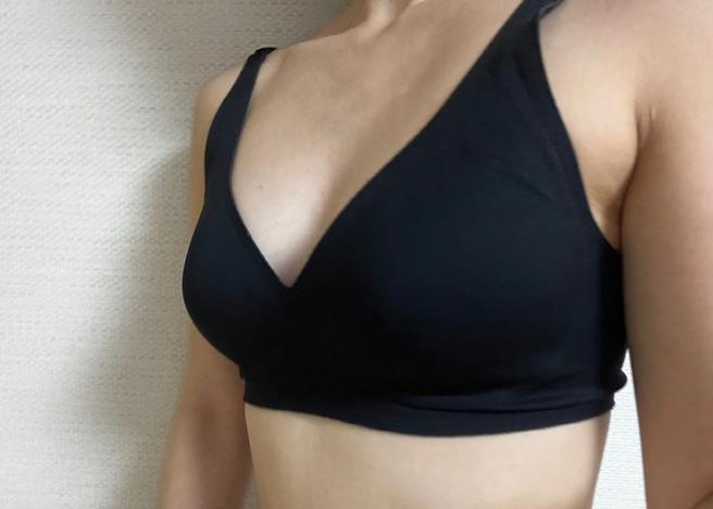 PRP Breast Fat Grafting