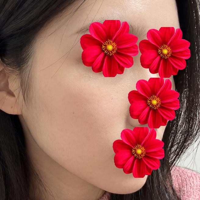 쥬베룩 한 달차, 슬슬 콜라겐 차오르는 느낌이에용
