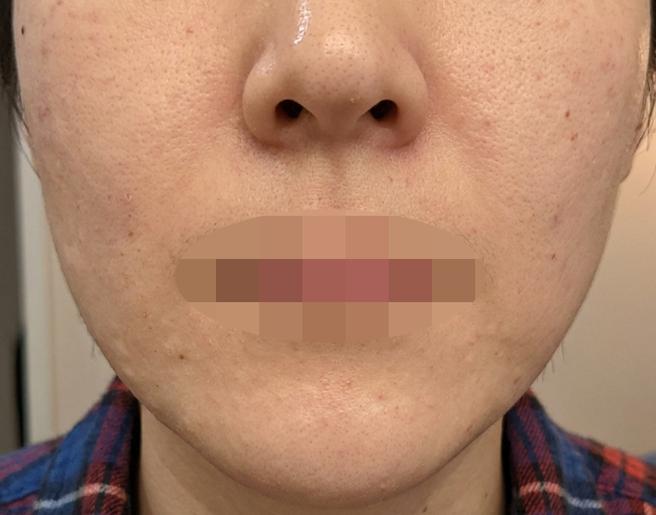 2일 차부터 속부터 느낌 다른 리쥬베룩, 받길 잘했습니다.