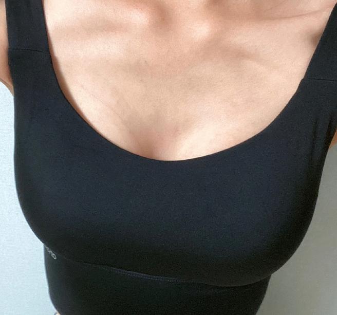 PRP Breast Fat Grafting