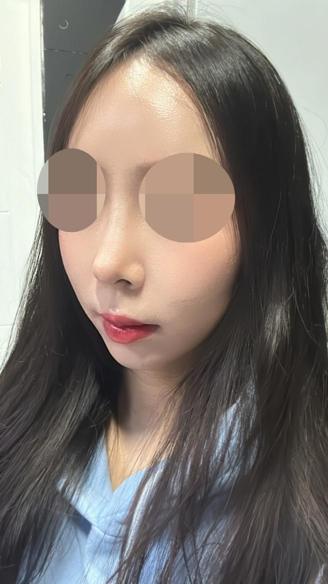 엘라스티꿈 실리프팅