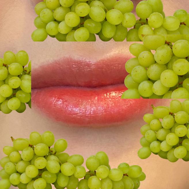 입술필러 3일차, 자연스럽게 볼륨 살아났어요