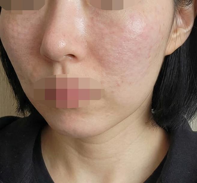 과잉 권유 없이 꼼꼼하게 해주셔서 좋았어요!!
