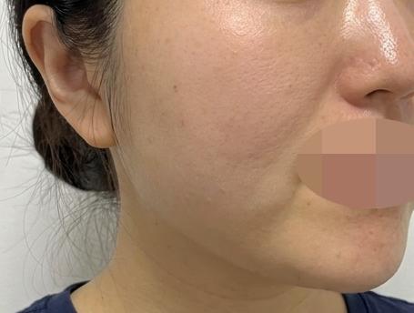깨끗한 시설에 좋은 접근성까지 시술도 만족스러웠습니다~
