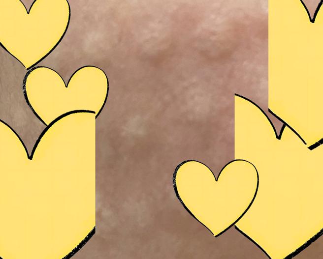 리쥬란 3일차, 생각보다 빠르게 가라앉았어요