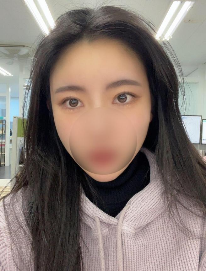 安心の目の再手術