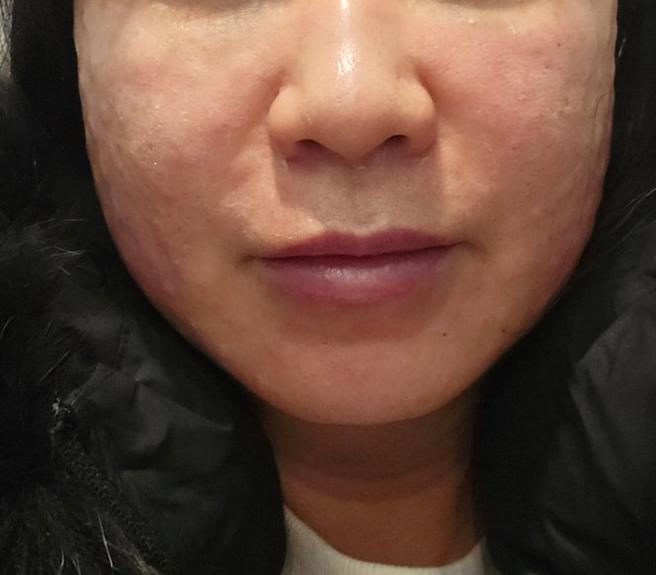 예약대로 진행되고 편해서 꾸준히 다녀보려고요~