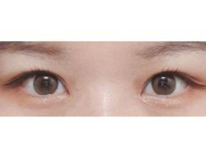 開眼角