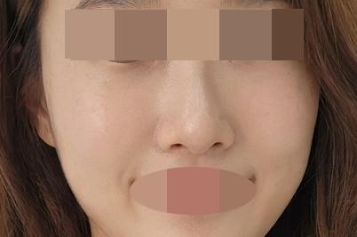 아이써마지 450샷
