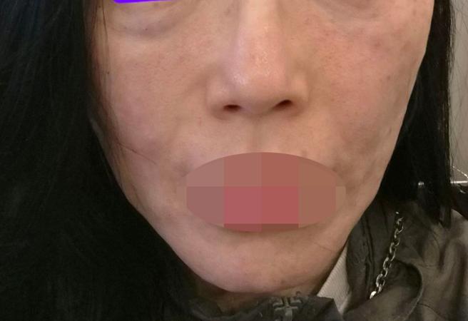 지인 소개로 방문한 곳, 부담 없이 받기 좋은 리쥬란 후기예요ㅎㅎ