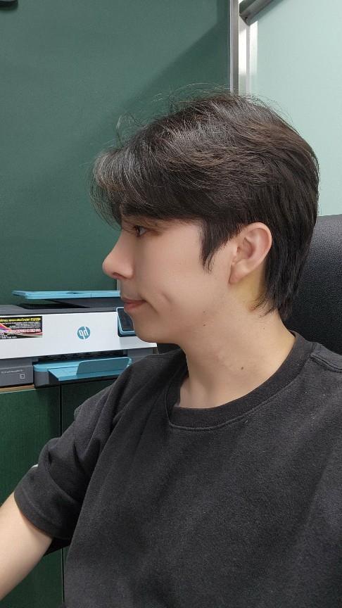 男性眼睛矫正