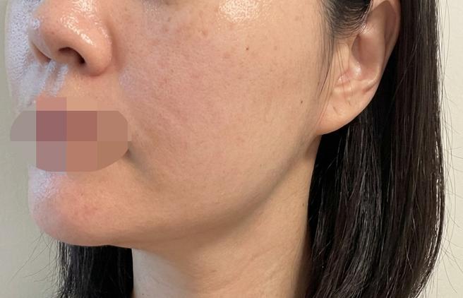거칠해지고 모공 늘어진 피부 고민, 쥬베룩으로 잡으러 다녀왔어요!