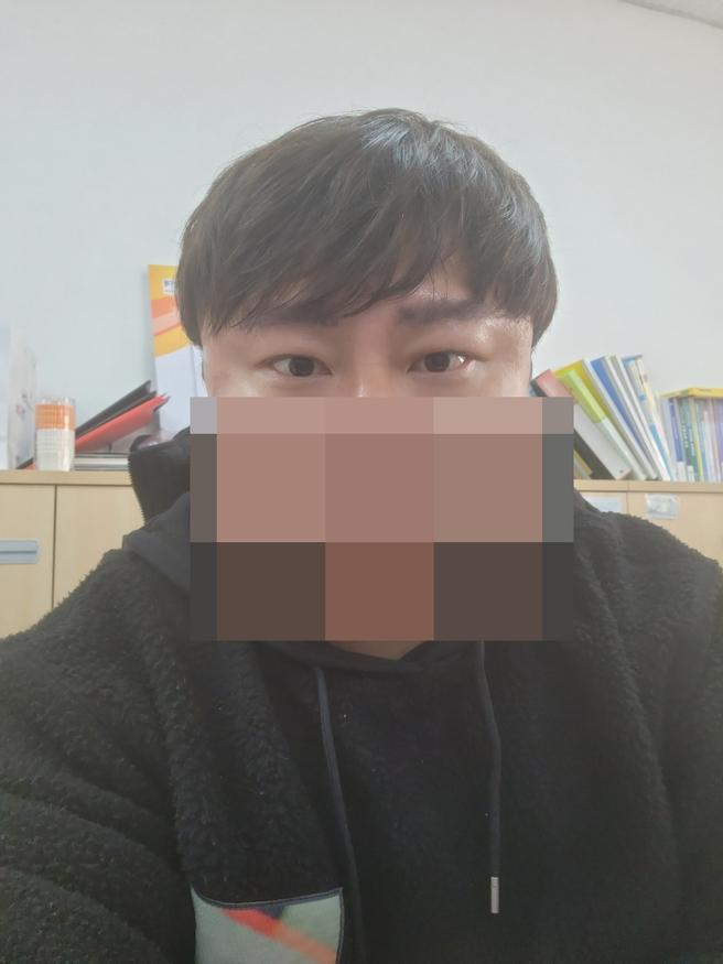 男性眼睛矫正