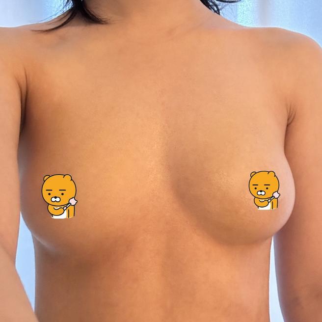 Stem Cell Chest Fat Grafting