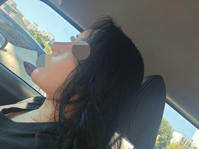 放心鼻整形手術