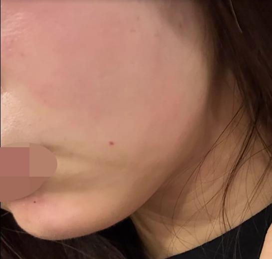 친절한 응대에 통증 없는 시술까지, 다시 한국 올 때 꼭 방문할 곳이에요~!