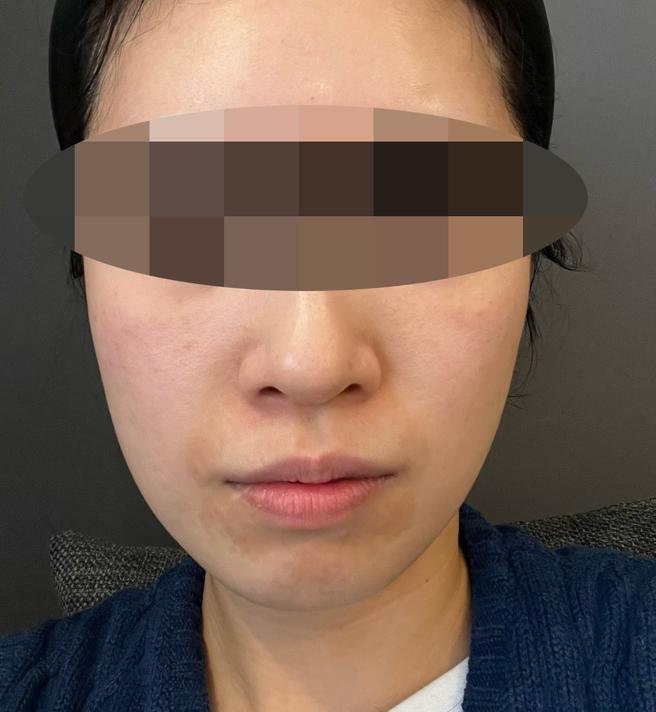 쥬베룩아이 3회 끊었는데 1회차부터 대박인 것 같아요ㅎㅎ