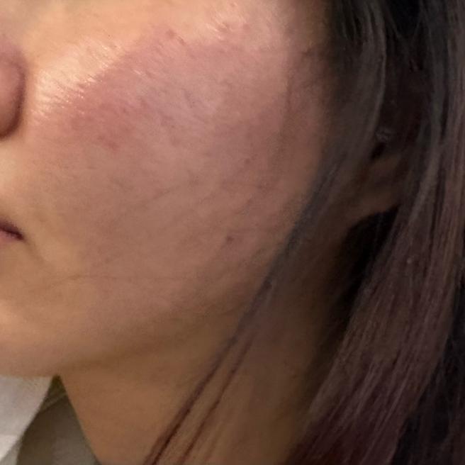 여기 원장님 잘해주셔서 담달에 또 오려고요 ㅎㅎ