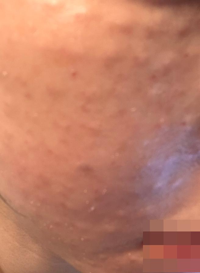 리즈네는 여기서만! 효과부터 응대까지 다 만족이에요~~