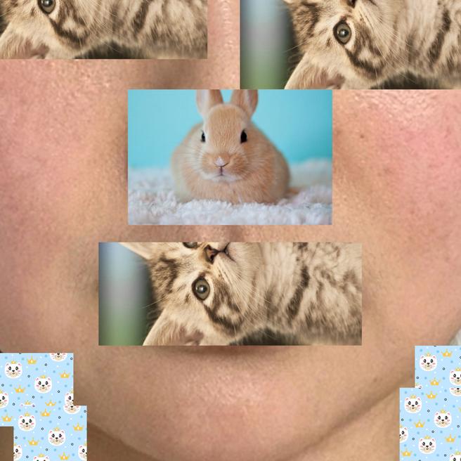 온다 레이저로 탄력 있는 V라인을 기대하며
