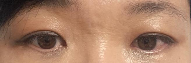 ทำตาบนและตาล่าง