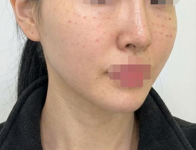 나비존 모공 때문에 받았는데, 받길 잘한 것 같네요~ㅎㅎ