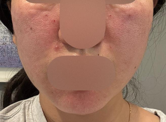 빠른 응대에 꼼꼼한 케어까지, 모공 관리는 여기서 받을라고요~ㅎㅎ