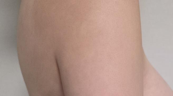 Reduce Chest