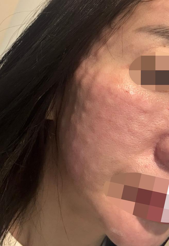 엠보 빵빵하게 잘 잡혀서 대만족이라 재방문 할려고요ㅎㅎ