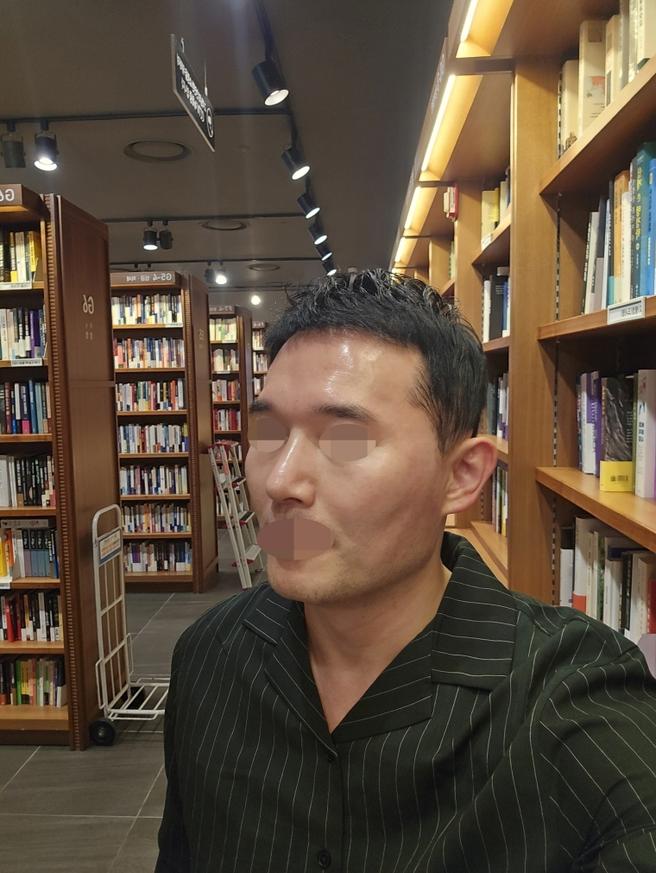 男性鼻整形