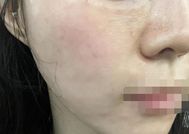 눈 앞에서 정품 인증해 주시고 수면으로 편하게 받고 왔어요~!!